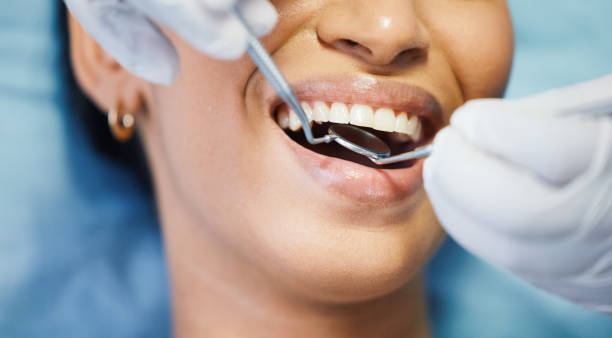 Best Emergency Tooth Extraction  in Tladega, AL