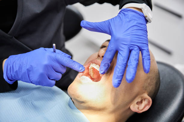 Best Tooth Infection Emergency Dentist  in Tladega, AL